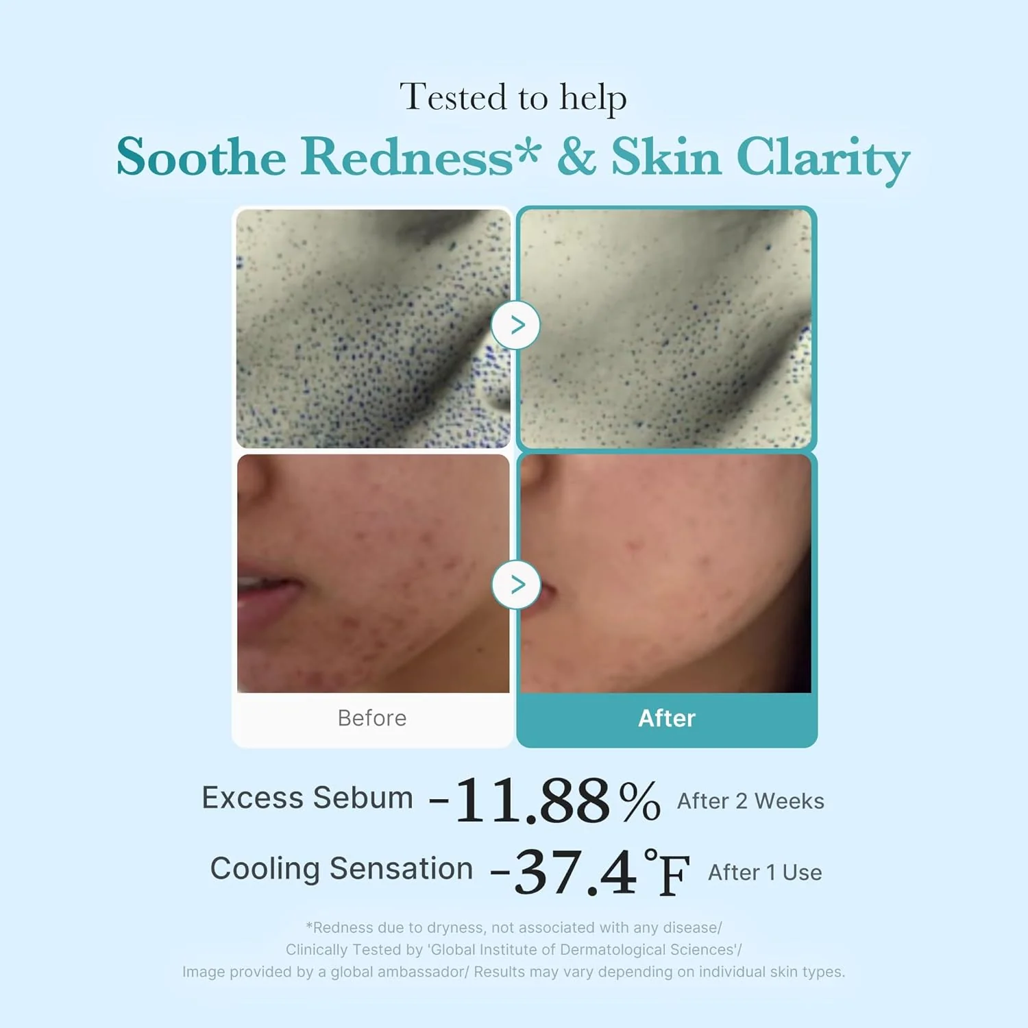 Azelaic Acid Niacinamide Clear Toner - Image 5