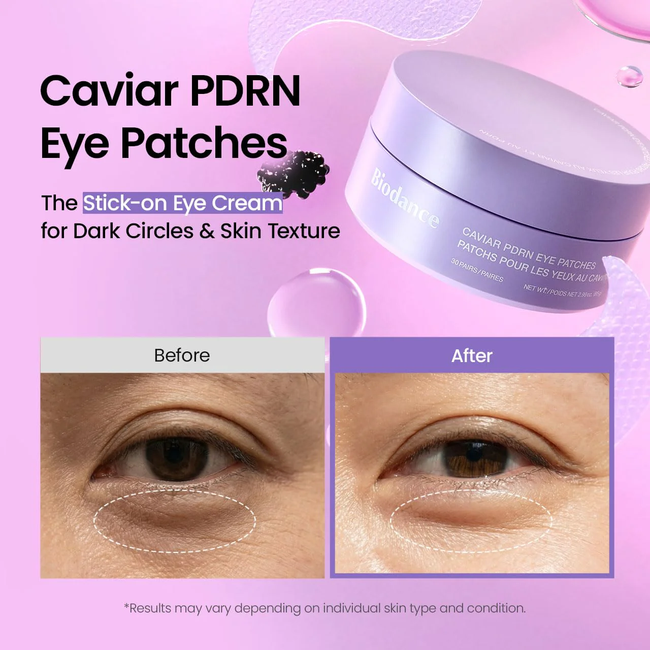 Caviar PDRN Eye Patches - Image 3