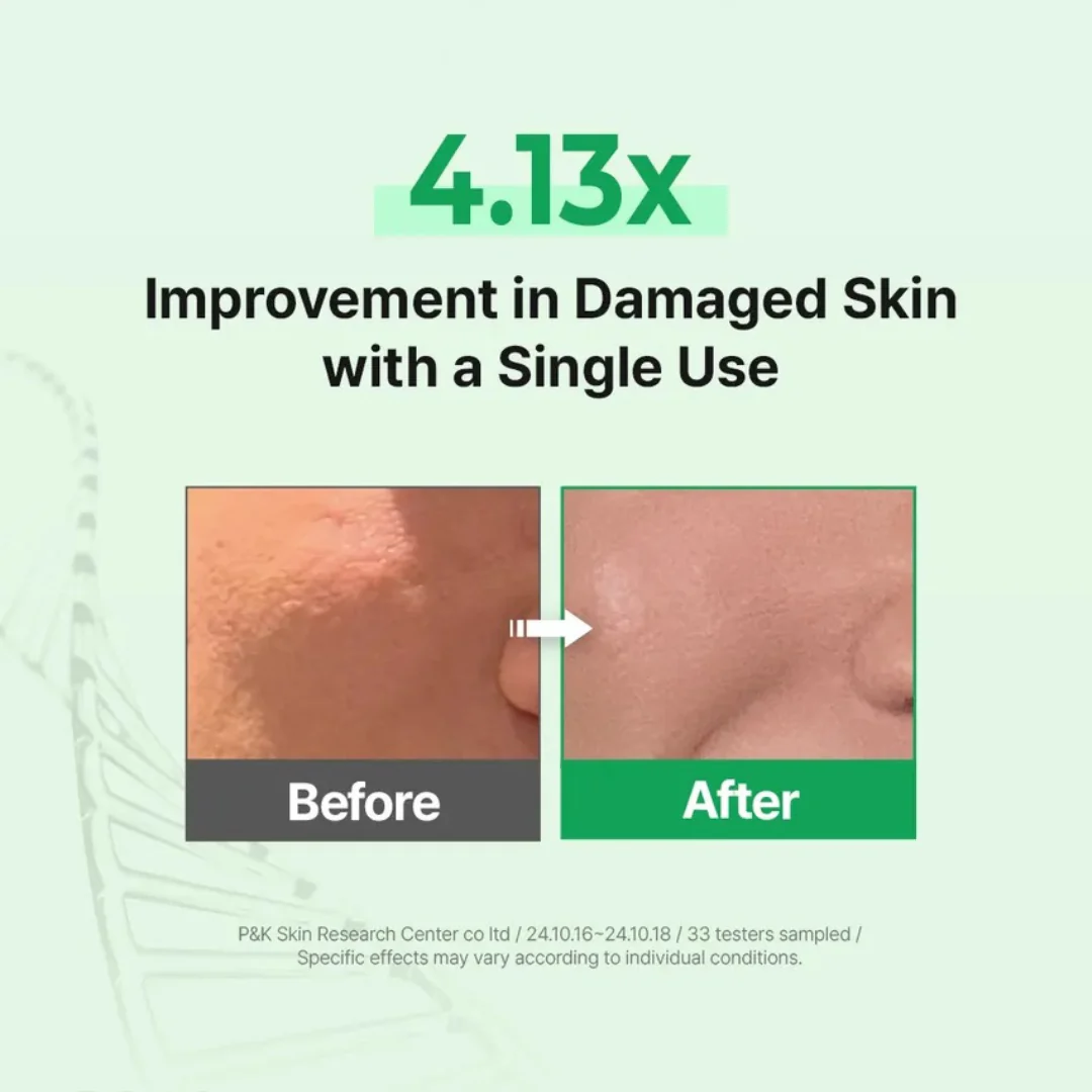 EGF Skin Barrier Cleansing Foam - Image 4