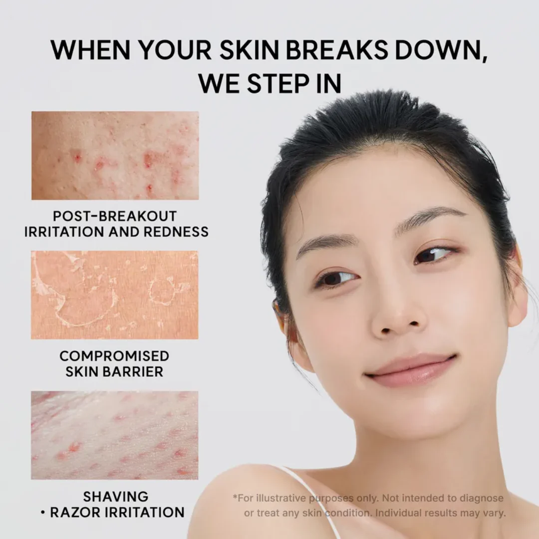 Eraser Soothing Cream - Image 6