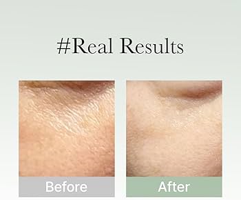 Holy Hyssop Serum 30 - Image 5