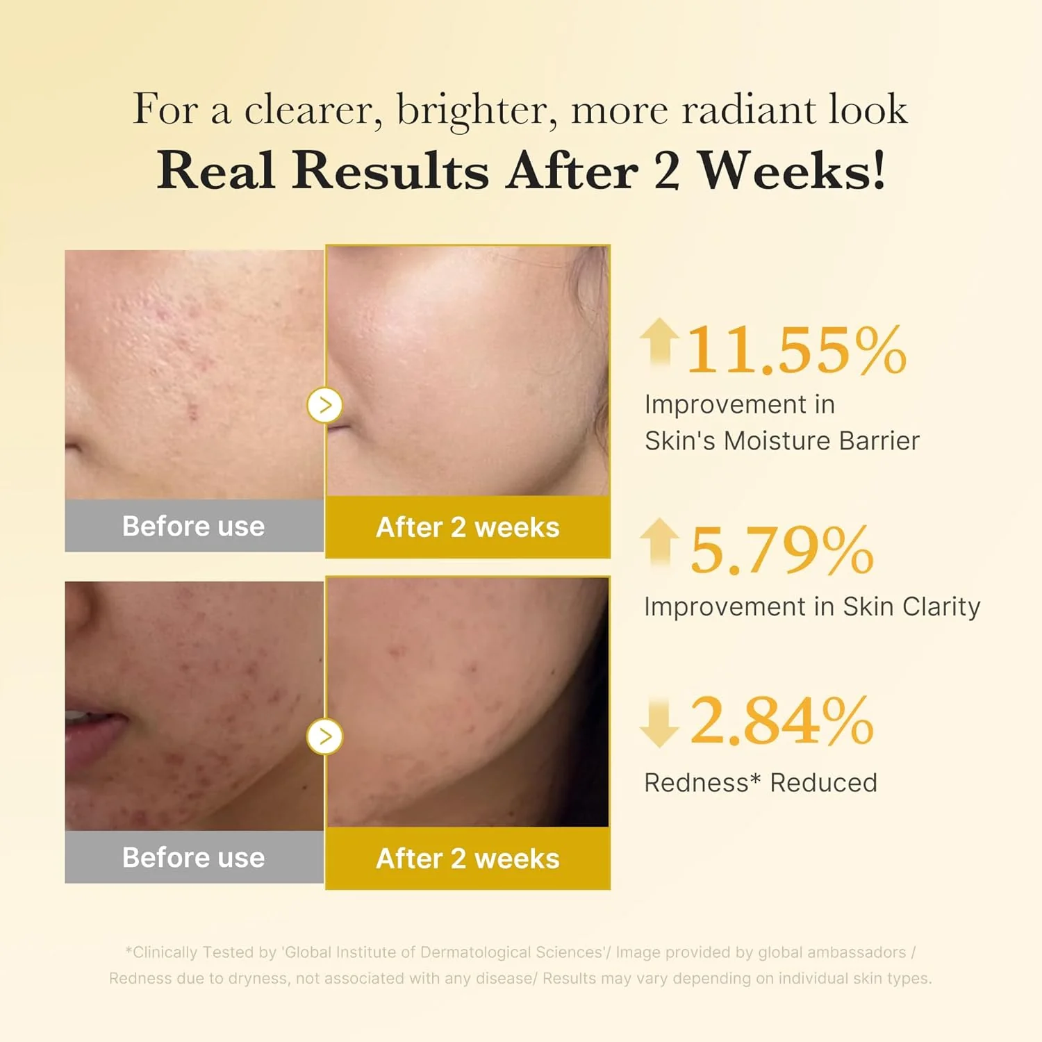 Kojic Acid Turmeric Niacinamide Serum - Image 7
