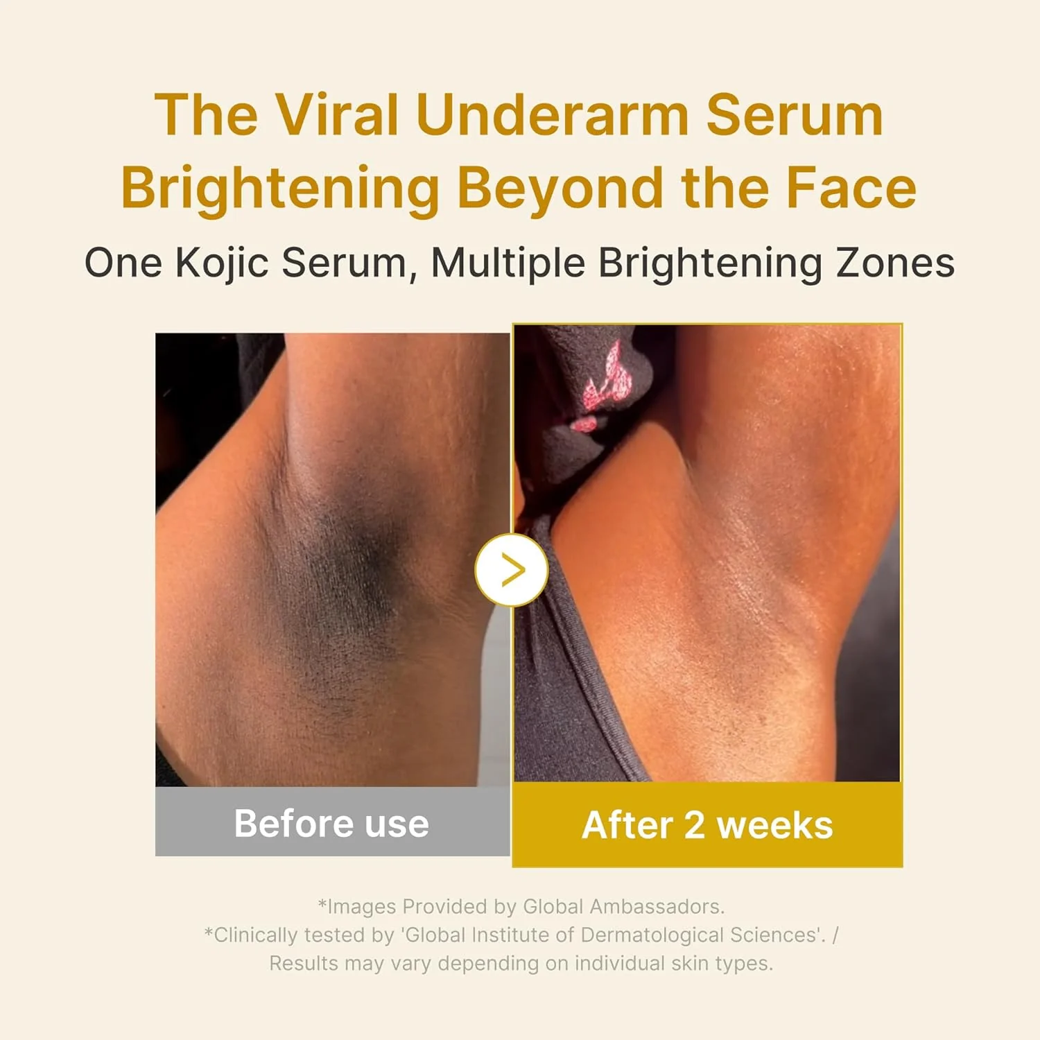 Kojic Acid Turmeric Niacinamide Serum - Image 8
