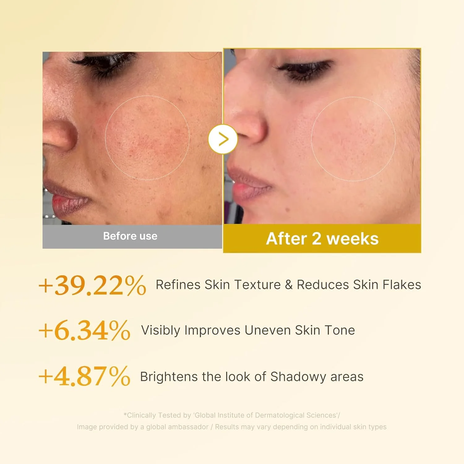 Kojic Acid Turmeric Resurfacing Toner - Image 5
