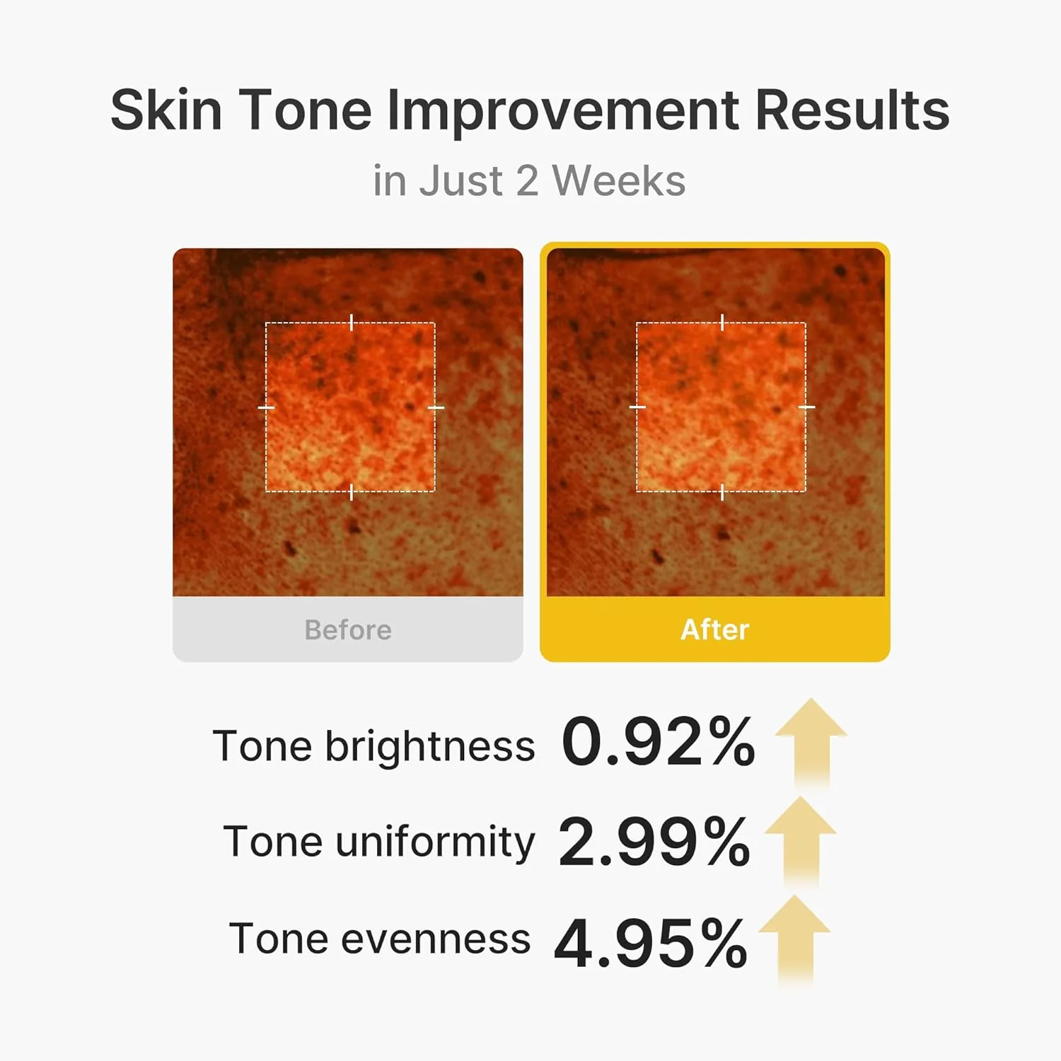 Kojic Acid Turmeric Vita Capsule Cream - Image 7
