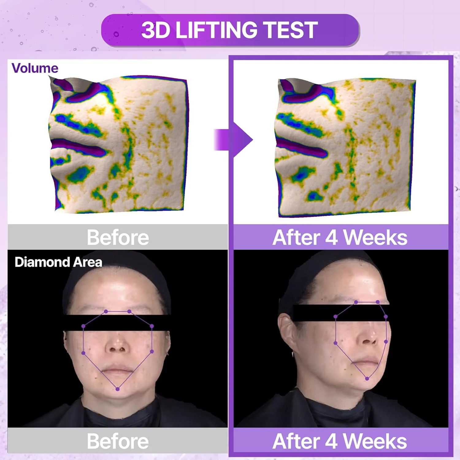 Probioderm 3D Lifting Ampoule - Image 4