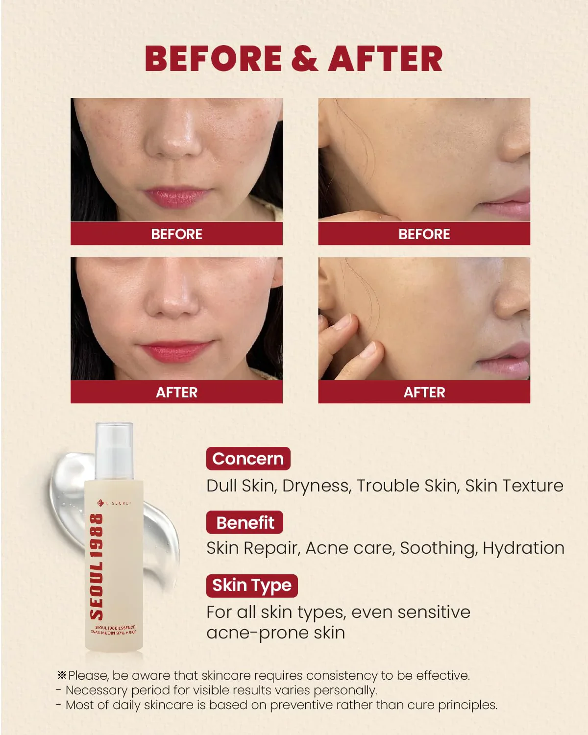 SEOUL 1988 Essence : Snail Mucin 97% + Rice - Image 5