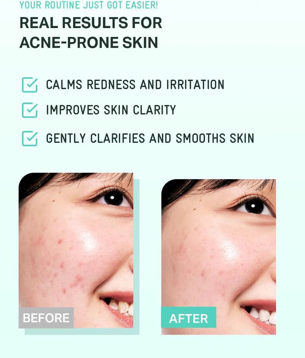 Tea Tree Cica Soothing Toner - Image 6