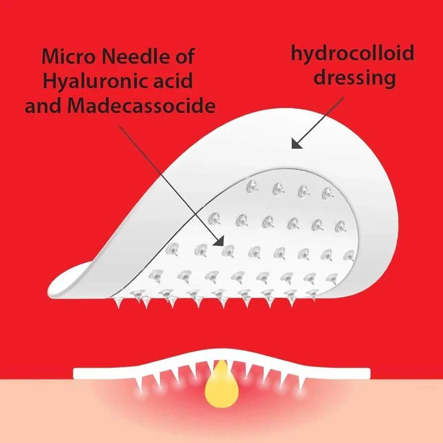 Trouble Clear Needle Patch - Image 3