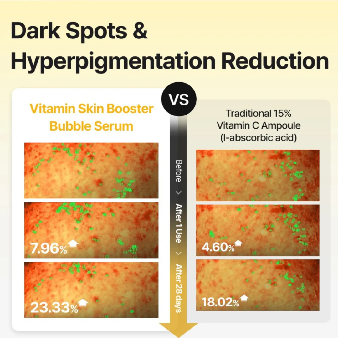 Vitamin Skin Booster Bubble Serum - Image 3