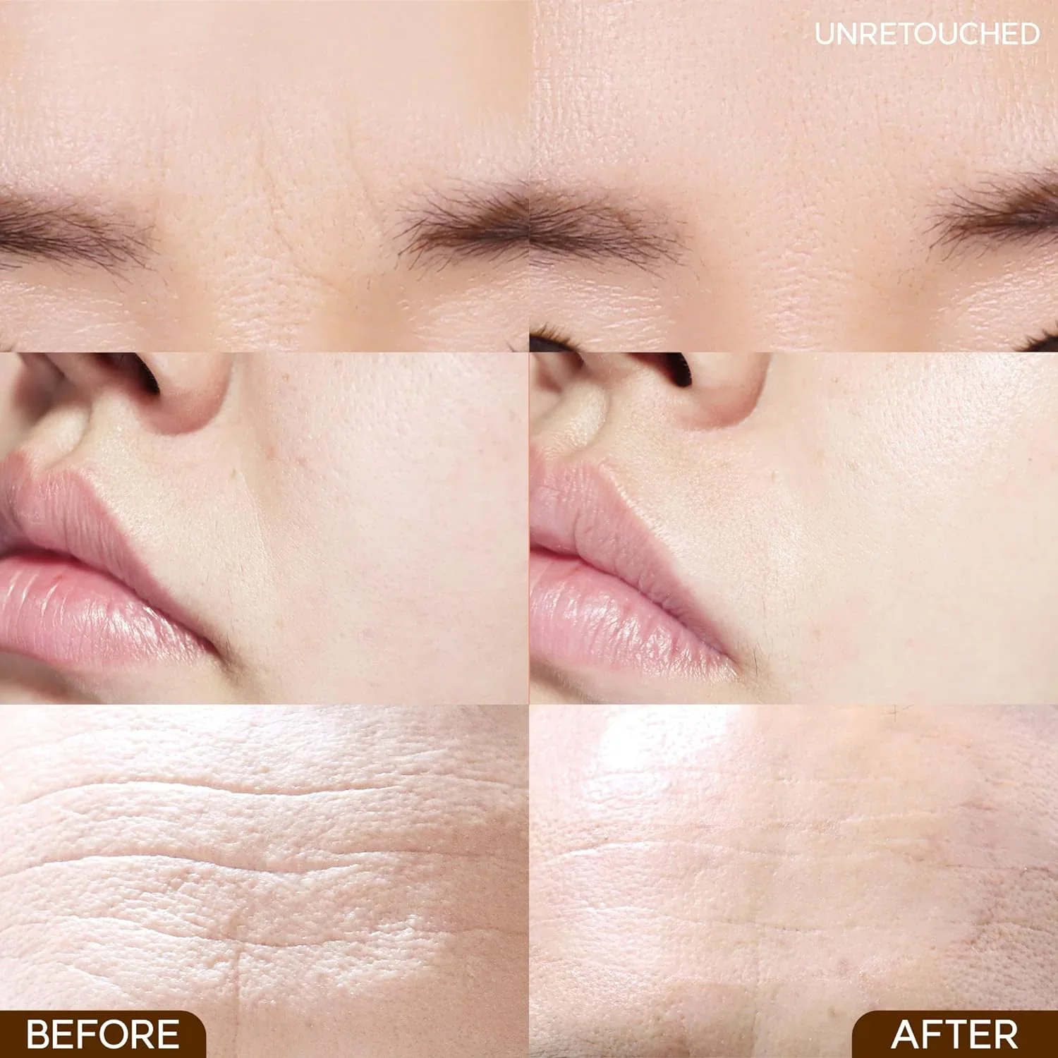Wrinkle Repair Frown Line Patch - Image 5